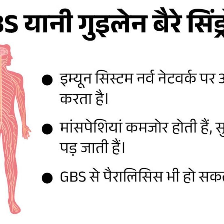महाराष्ट्र में GB सिंड्रोम से 7वीं मौत:37 साल के युवक की जान गई; एक्टिव केस 192 पर पहुंचे, इनमें 48 ICU और 21 वेंटिलेटर पर
