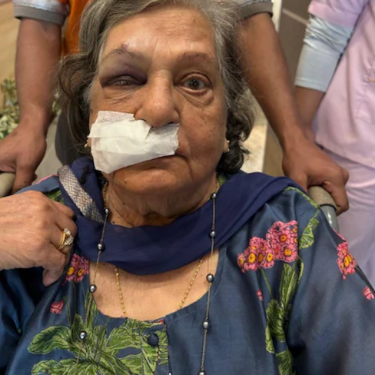एअर इंडिया ने व्हीलचेयर देने से मना किया:82 साल की बुजुर्ग महिला को गिरने से चोट लगी, दो दिन से ICU में भर्ती
