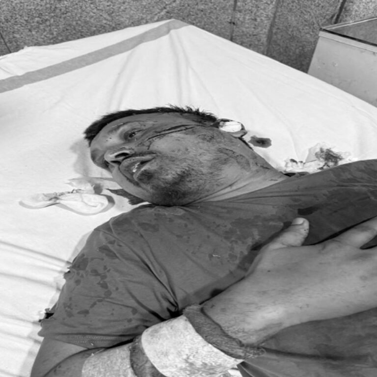 केके श्रीवास्तव के करीबी कांग्रेसी नेता पर जेल में हमला:धारदार हथियार से चेहरे पर अटैक; गंभीर हालत में अस्पताल में भर्ती