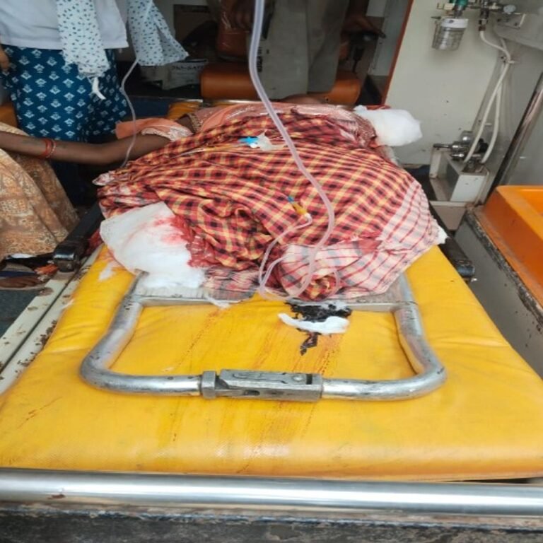 बालोद में ट्रेन की चपेट में आई महिला:हाथ-पैर कटकर हुए अलग, दर्द से तड़पती रही, गंभीर हालत में राजनांदगांव मेडिकल कॉलेज रेफर