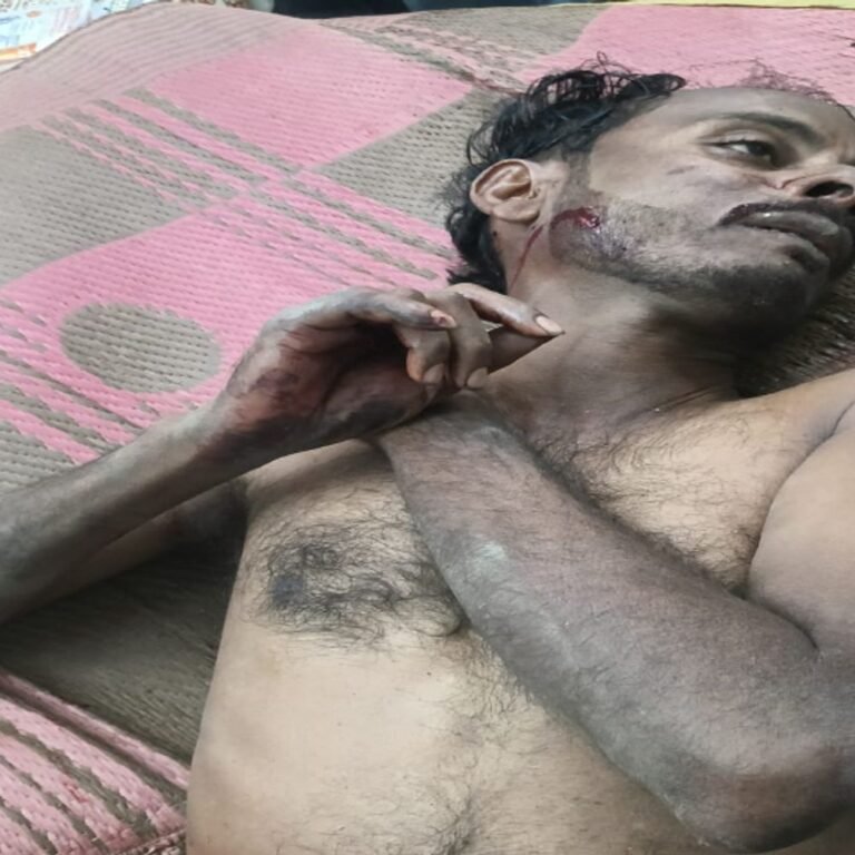 रायपुर में बेटे ने पिता को हसिया से काट डाला:बाइक खरीदने से नाराज था पिता, तोड़फोड़ करने पर हुआ था विवाद