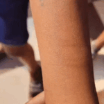 ब्लेड-पिन-कांटे से 35 स्कूली बच्चों ने हाथ काटे:खेल-खेल में एक दूसरे को टास्क दिया; प्रिंसिपल-हेडमास्टर को नोटिस; कौन सा गेम इसकी जांच होगी