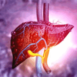 वर्ल्ड लिवर डे…गलत लाइफस्टाइल खराब कर सकती है लिवर:शराब ही कारण नहीं, डॉक्टर बोले- समोसा-पिज्जा फैटी लिवर के लिए जिम्मेदार, जानिए बचने के उपाय