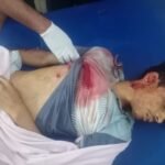 कांग्रेस नेता के बेटे के सिर-सीने में मारी गोली, मौत:जांजगीर में 3 नकाबपोशों ने घर में घुसकर फायरिंग की; छोटे भाई को भी लगी बुलेट