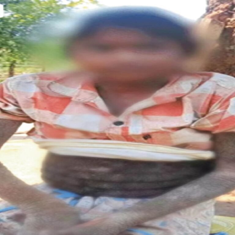 लालच ने छीनी मासूम की मदद:दुर्लभ बीमारी से पीड़ित बच्ची की मदद के लिए यूट्यूबर्स ने जुटाए एक लाख रुपए लेकिन दिए नहीं