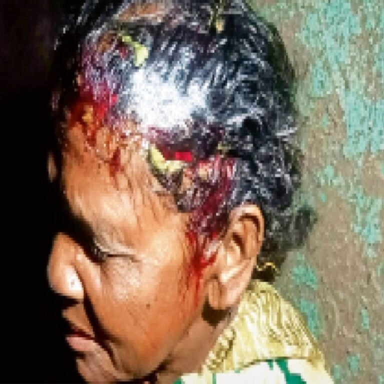 दुधावा में आदमखोर तेंदुए की वापसी:पांच दिन में 3 ग्रामीणों पर तेंदुए का हमला सो रही बुजुर्ग महिला को 20 मीटर घसीटा