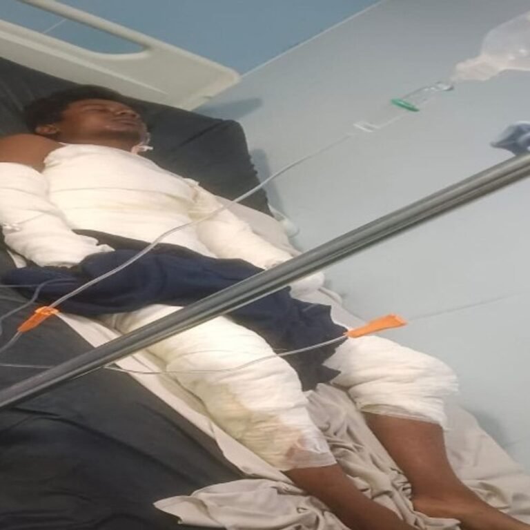 युवक को दोस्तों ने जिंदा जलाकर मार डाला:शराब पार्टी के बहाने घर से ले गए, विवाद के बाद पेट्रोल उड़ेलकर लगाई आग