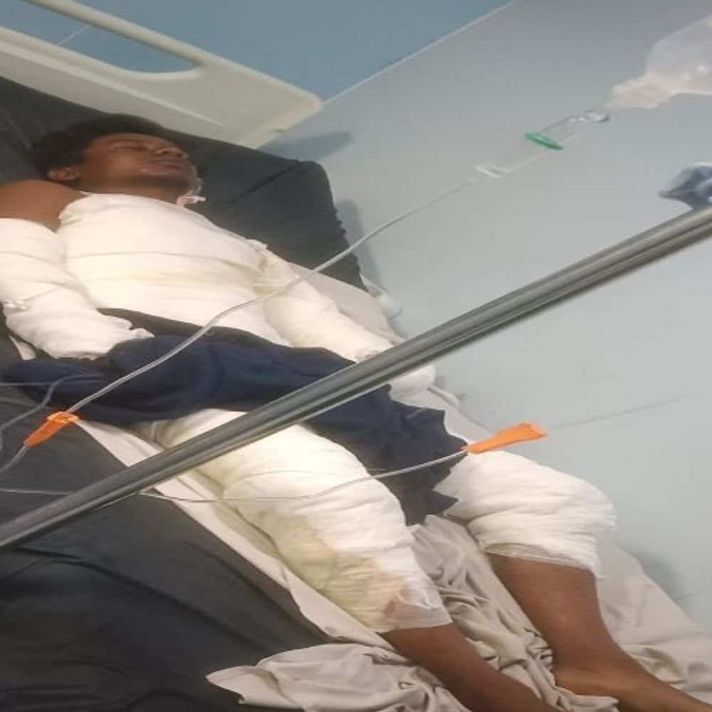 युवक को दोस्तों ने जिंदा जलाकर मार डाला:शराब पार्टी के बहाने घर से ले गए, विवाद के बाद पेट्रोल उड़ेलकर लगाई आग